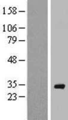 Western Blot: RAB40A Overexpression Lysate [NBP2-05749]