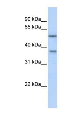 Western Blot: RAB40B Antibody [NBP1-58922]