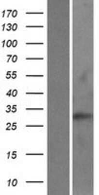 Western Blot: RAB40C Overexpression Lysate [NBP2-06552]