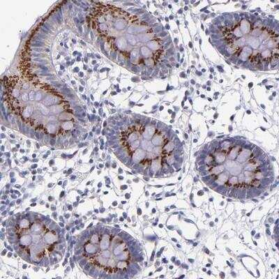 Immunohistochemistry: RAB41 Antibody [NBP1-86528]