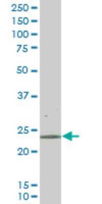 Western Blot: RAB43 Antibody (5G4) [H00339122-M01]