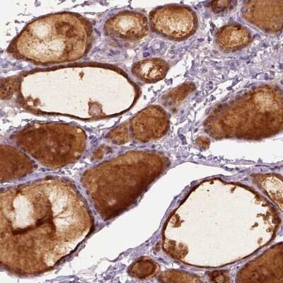 Immunohistochemistry: RAB43 Antibody [NBP2-49309]