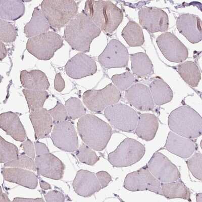 Immunohistochemistry-Paraffin: RAB43 Antibody [NBP2-49309]