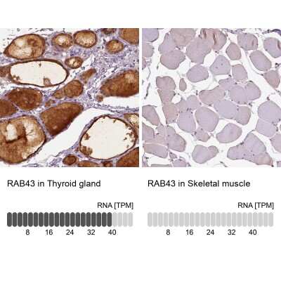 Immunohistochemistry-Paraffin: RAB43 Antibody [NBP2-49309]