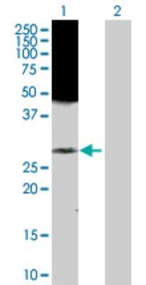 Western Blot: RAB43 Antibody [H00339122-D01P]