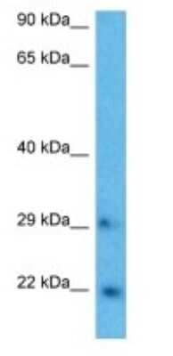 Western Blot: RAB43 Antibody [NBP3-09514]