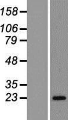 Western Blot: RAB43 Overexpression Lysate [NBL1-15079]