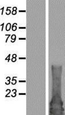 Western Blot: RAB4B Overexpression Lysate [NBP2-07079]