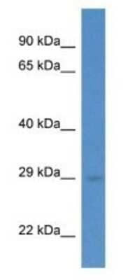 Western Blot: RAB5C Antibody [NBP1-74182]