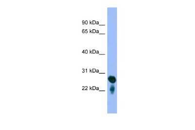 Western Blot: RAB5C Antibody [NBP2-88115]