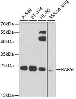 Western Blot: RAB5C AntibodyBSA Free [NBP2-93051]