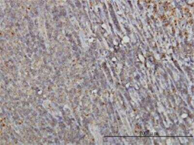 Immunohistochemistry-Paraffin: RAB6A Antibody (3G3) [H00005870-M01]