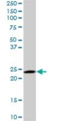 Western Blot: RAB6A Antibody (3G3) [H00005870-M01]
