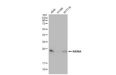 Western Blot: RAB6A Antibody (HL1047) [NBP3-13701]