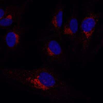 Immunocytochemistry/ Immunofluorescence: RAB6A Antibody [NBP1-33110]