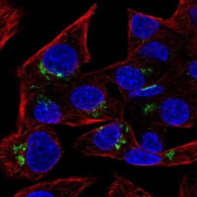 Immunocytochemistry/ Immunofluorescence: RAB6A Antibody [NBP2-32386]