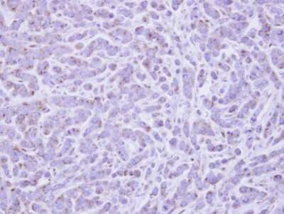 Immunohistochemistry-Paraffin: RAB6A Antibody [NBP1-33110]
