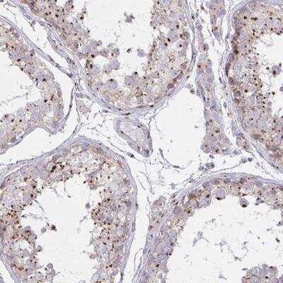 Immunohistochemistry-Paraffin: RAB6A Antibody [NBP2-32386]