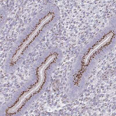 Immunohistochemistry-Paraffin: RAB6A Antibody [NBP2-32386]
