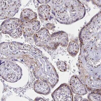 Immunohistochemistry-Paraffin: RAB6A Antibody [NBP2-32386]