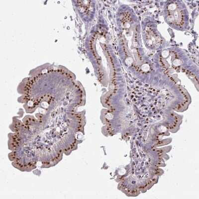 Immunohistochemistry-Paraffin: RAB6A Antibody [NBP2-32386]