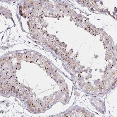 Immunohistochemistry-Paraffin: RAB6A Antibody [NBP2-32386]