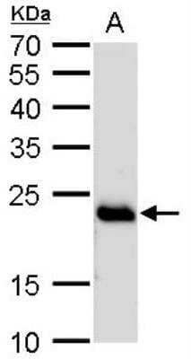 Western Blot: RAB6A Antibody [NBP1-33110]