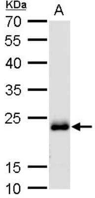 Western Blot: RAB6A Antibody [NBP1-33110]