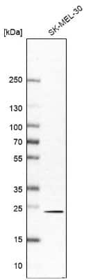 Western Blot: RAB6A Antibody [NBP2-32386]