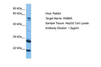 Western Blot: RAB6A Antibody [NBP2-88116]