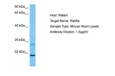 Western Blot: RAB6A Antibody [NBP2-88116]