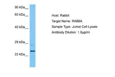 Western Blot: RAB6A Antibody [NBP2-88117]