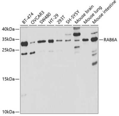 Western Blot: RAB6A AntibodyBSA Free [NBP2-94317]