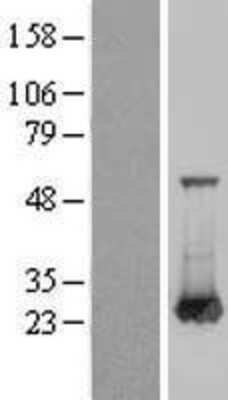 Western Blot: RAB6A Overexpression Lysate [NBL1-15084]