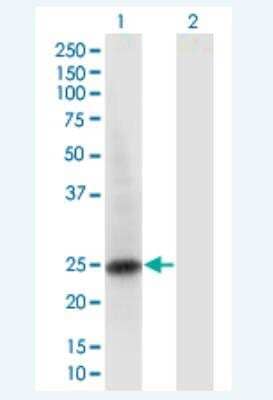 Western Blot: RAB6B Antibody (1A5) [H00051560-M02-100ug]