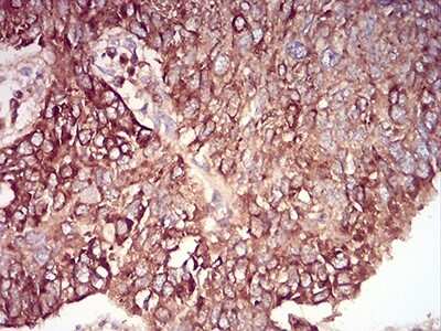 Immunohistochemistry: RAB6B Antibody (6D12E4) - BSA Free [NBP2-61825]