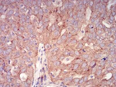 Immunohistochemistry: RAB6B Antibody (6D12E4) - BSA Free [NBP2-61825]