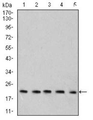 Western Blot: RAB6B Antibody (6D12G9)BSA Free [NBP2-61824]