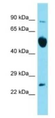 Western Blot: RAB6B Antibody [NBP3-09488]