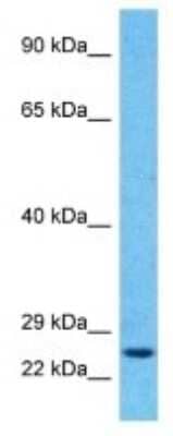 Western Blot: RAB6B Antibody [NBP3-09950]