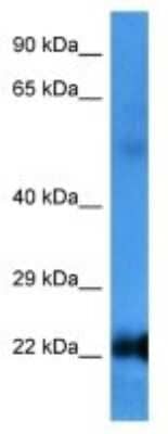 Western Blot: RAB6B Antibody [NBP3-10008]