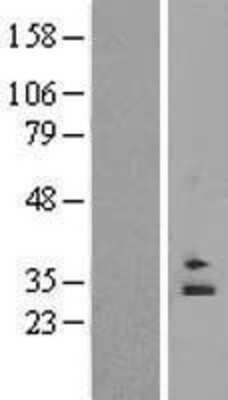 Western Blot: RAB6C Overexpression Lysate [NBP2-06078]