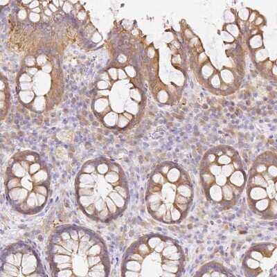 Immunohistochemistry-Paraffin: RAB6IP1 Antibody [NBP2-30443]