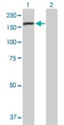 Western Blot: RAB6IP1 Antibody [H00023258-B01P]