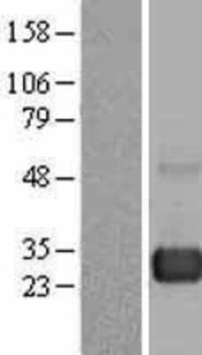 Western Blot: Rab7a Overexpression Lysate [NBL1-15087]