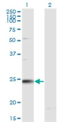 Western Blot: RAB7B Antibody (1C3) [H00338382-M02]