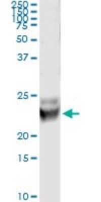 Immunoprecipitation: RAB7B Antibody (3B3) [H00338382-M01]