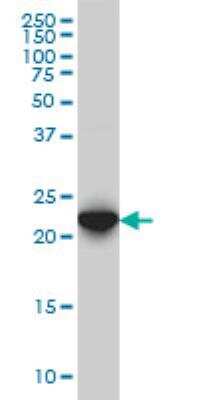 Western Blot: RAB7B Antibody (3B3) [H00338382-M01]