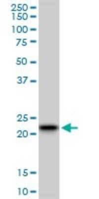 Western Blot: RAB7B Antibody (3B3) [H00338382-M01]