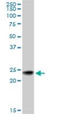 Western Blot: RAB7B Antibody (3B3) [H00338382-M01]